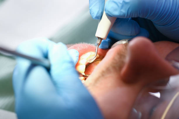 Best Emergency Gum Treatment in Muniz, TX