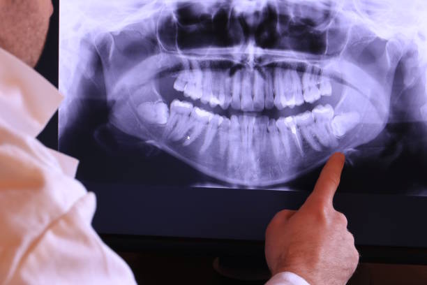 Best Emergency TMJ Treatment in Muniz, TX