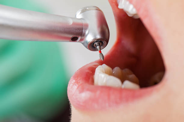 Best Emergency Gum Treatment in Muniz, TX
